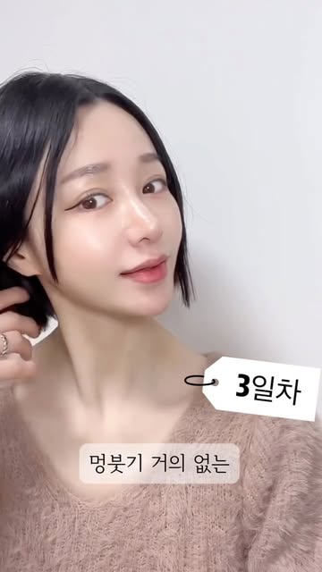 온리프의원 광고 소재