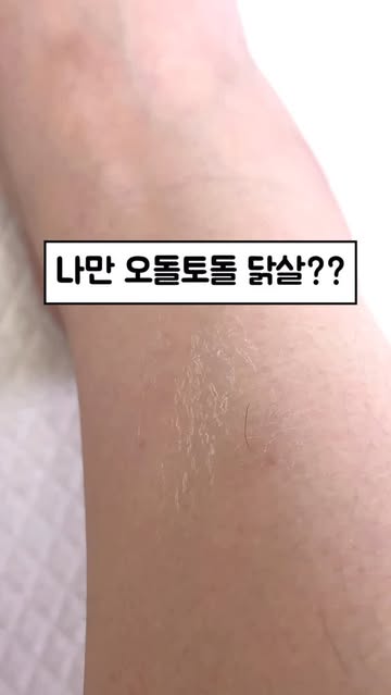 플루 광고 소재