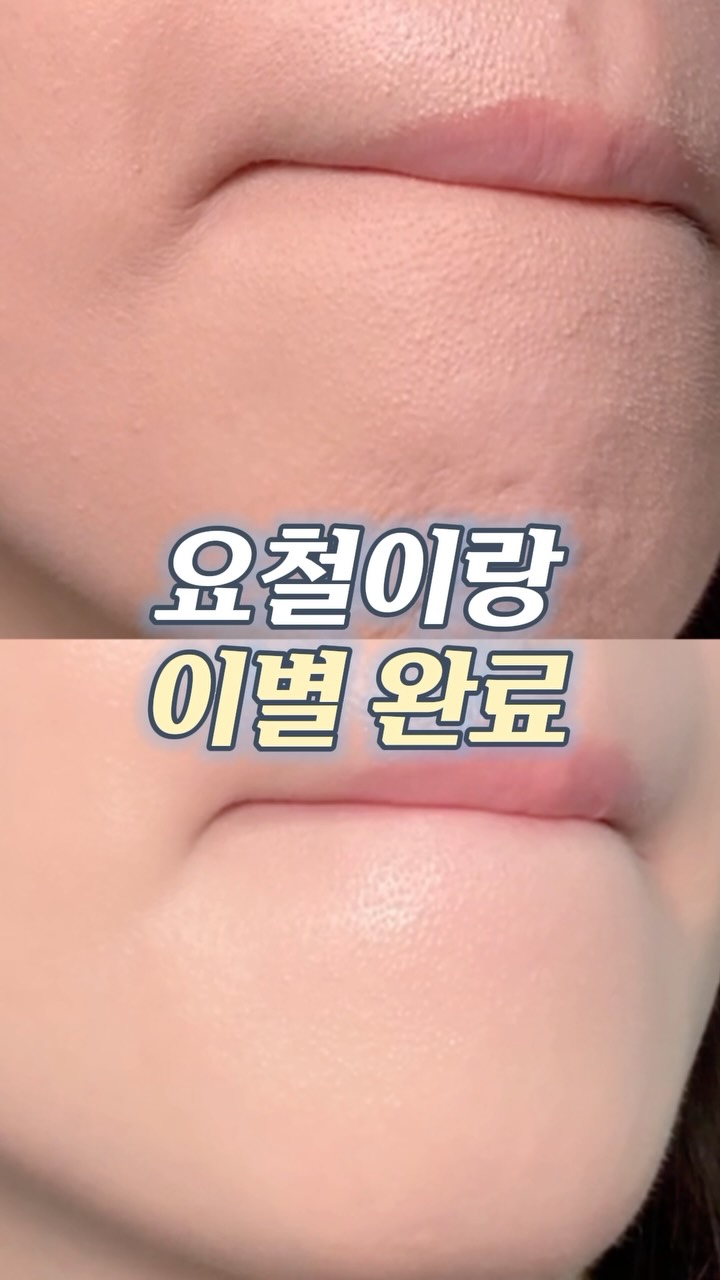 ISOI l 아이소이 광고 소재
