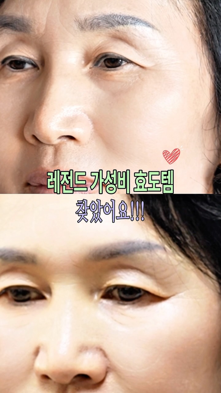 아이백 i100 광고 소재