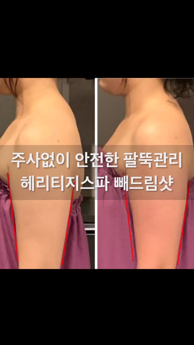 @redmarble_neat이 올린 헤리티지스파 태그 게시물