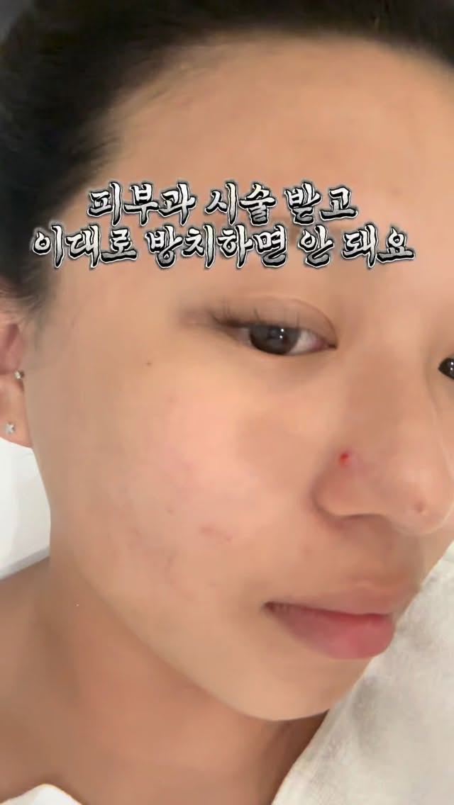 @yenny_beauty.zip이 올린 ABNC 태그 게시물