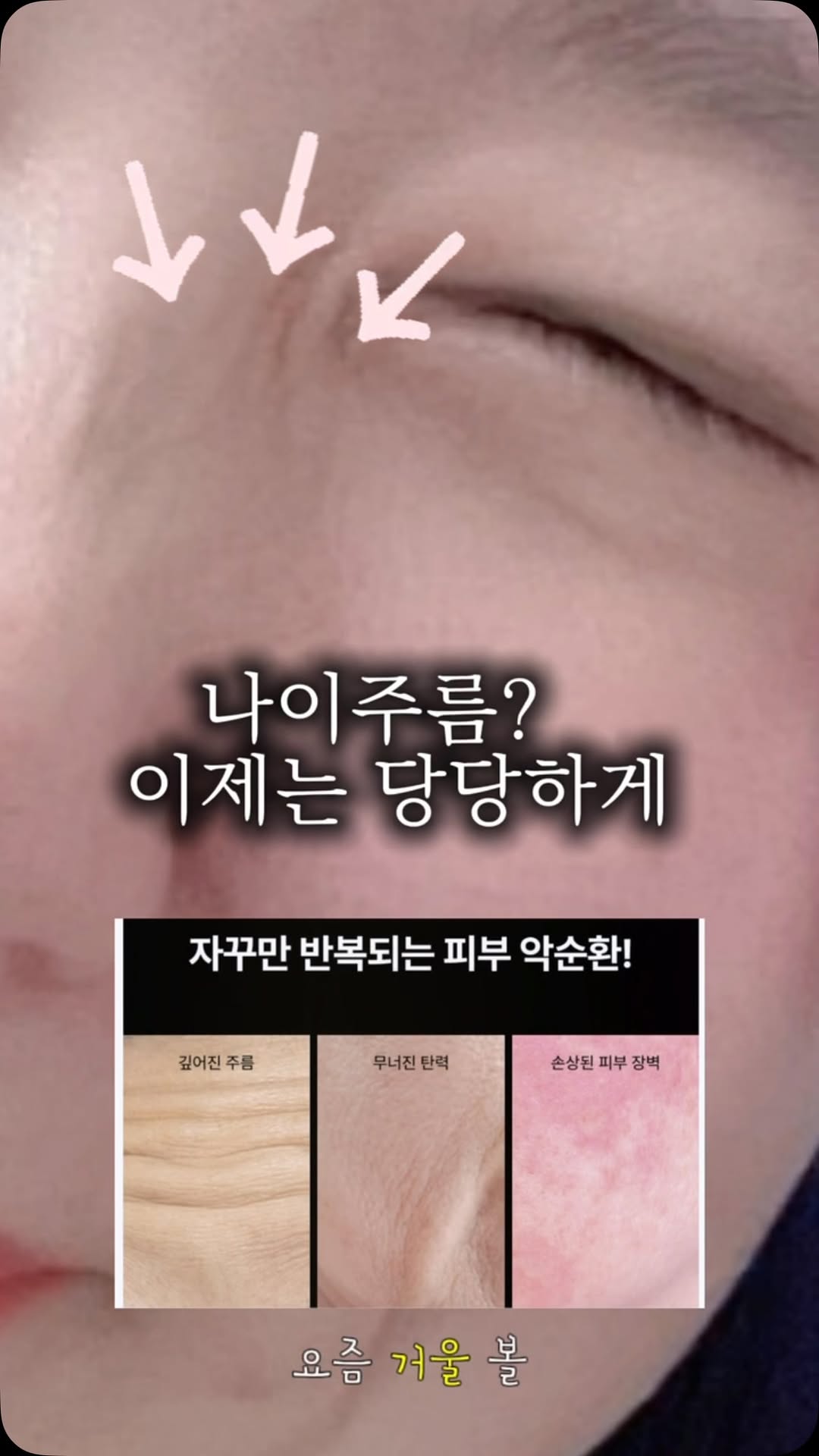 @purp.le_96이 올린 팔색미인 태그 게시물