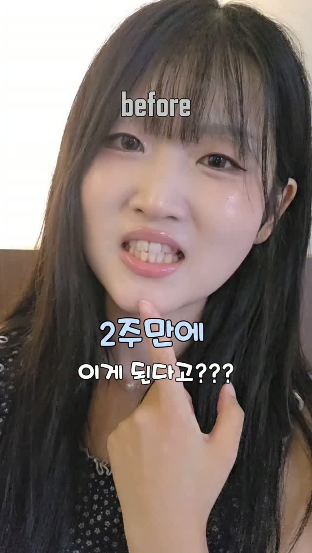 @minibeauty___이 올린 라이브오랄스 태그 게시물