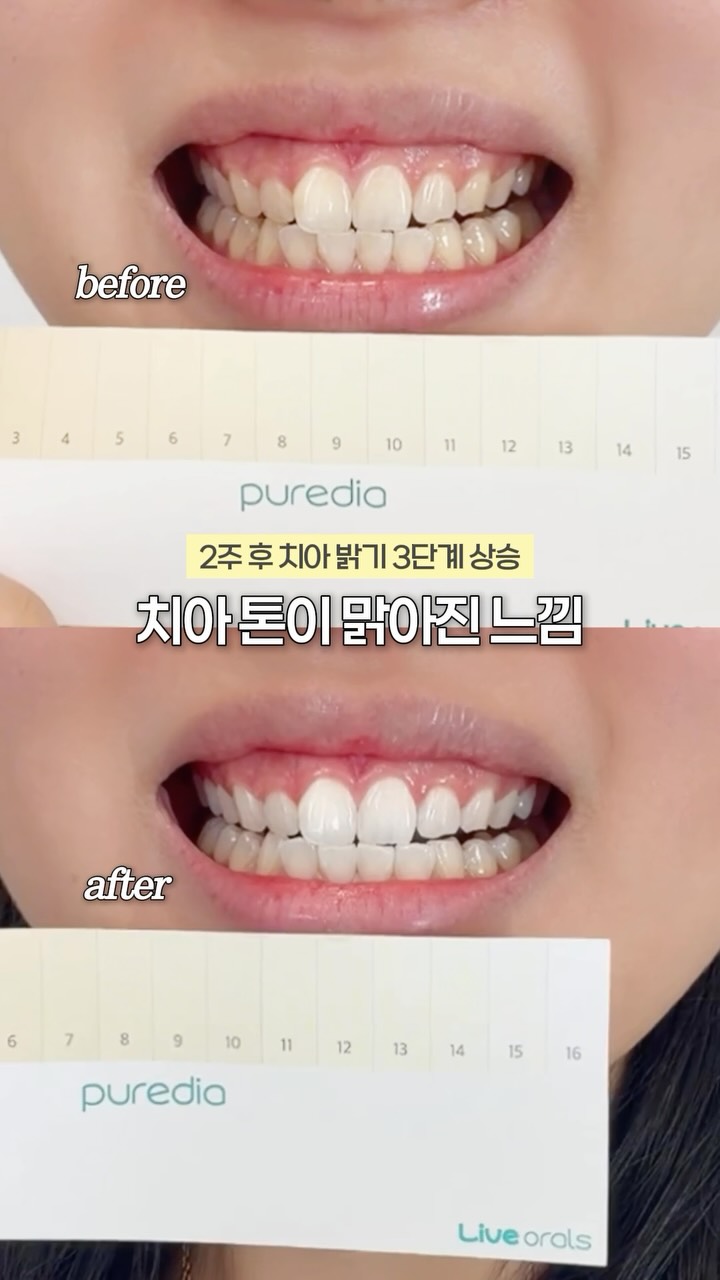 @yoonji_1228이 올린 라이브오랄스 태그 게시물