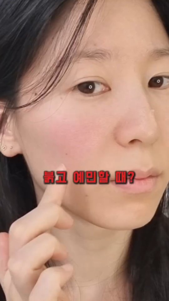 @nunkng이 올린 엑솜 태그 게시물