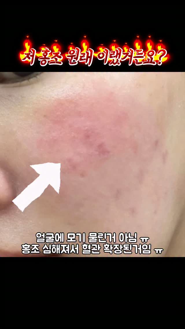 @5jmjm_이 올린 엑솜 태그 게시물