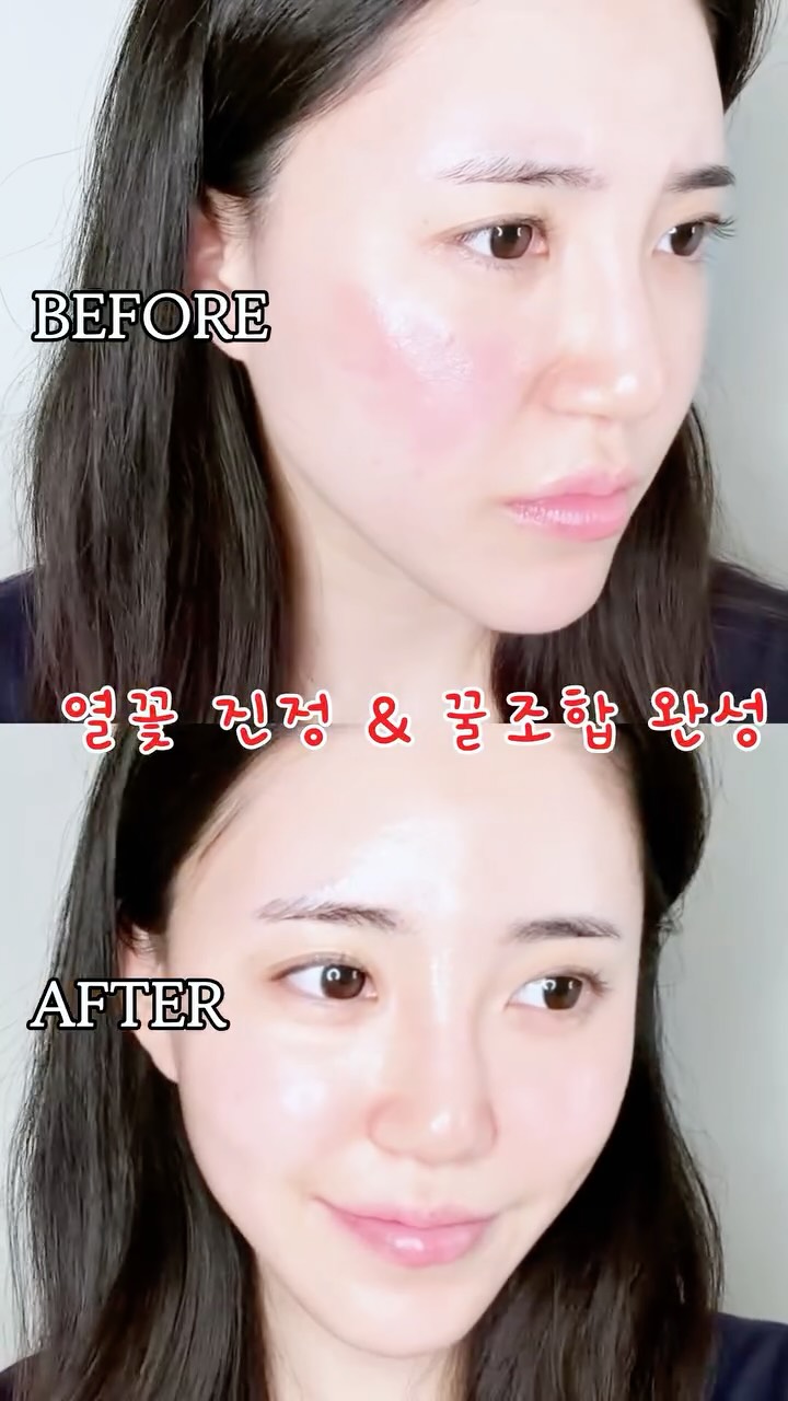 @my_ddun_beautylog이 올린 테라웨이브 태그 게시물