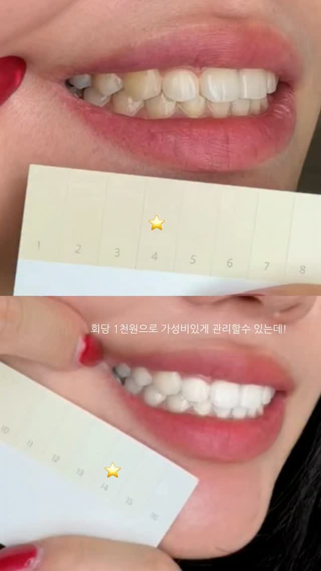@roro_mom_v이 올린 라이브오랄스 태그 게시물