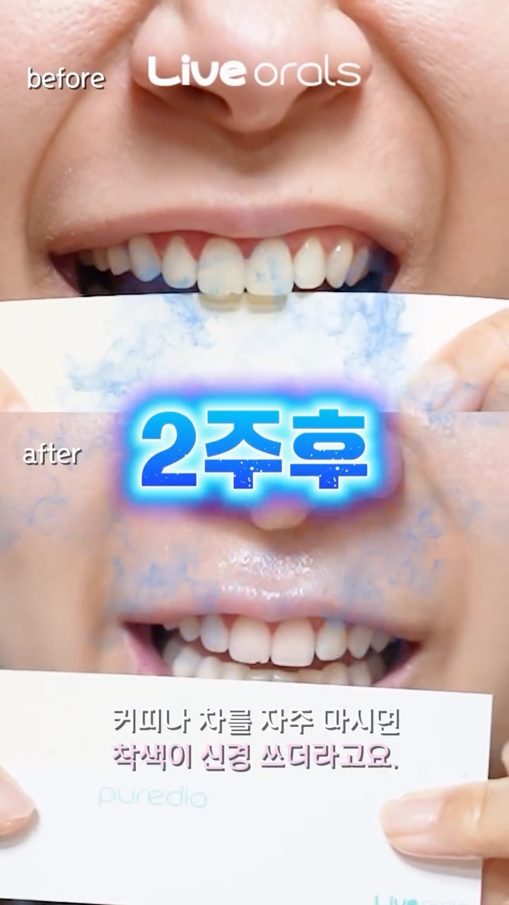 @u.momile이 올린 라이브오랄스 태그 게시물