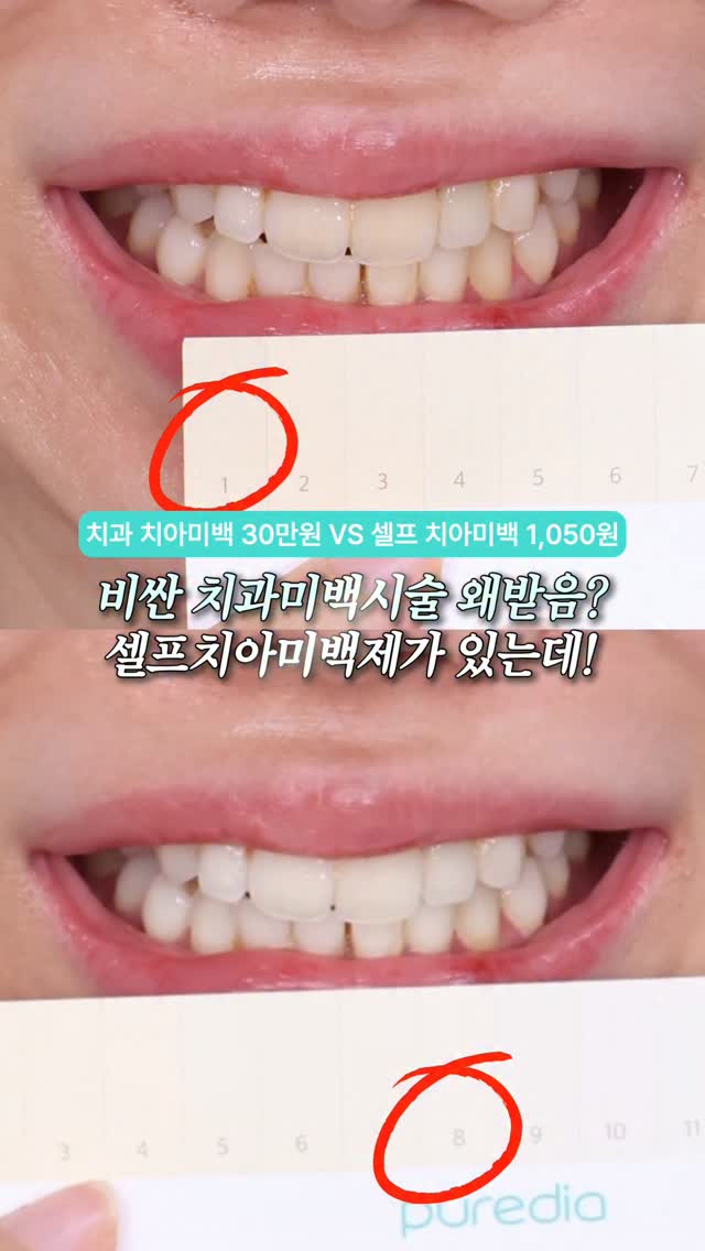 @gyong_motd이 올린 라이브오랄스 태그 게시물