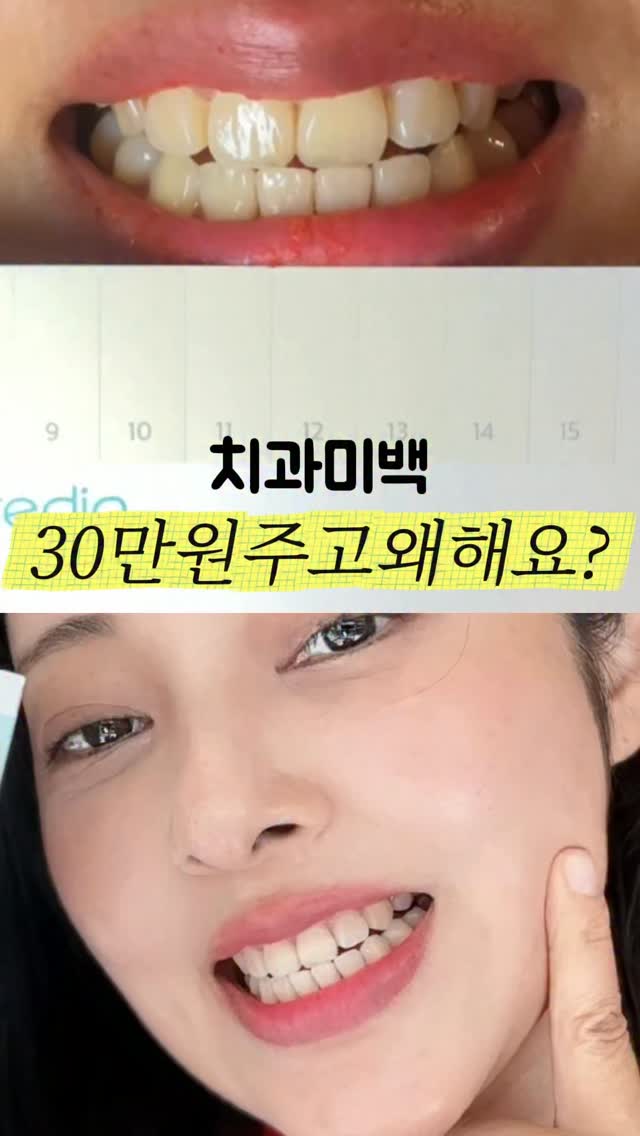 @daily_simby이 올린 라이브오랄스 태그 게시물