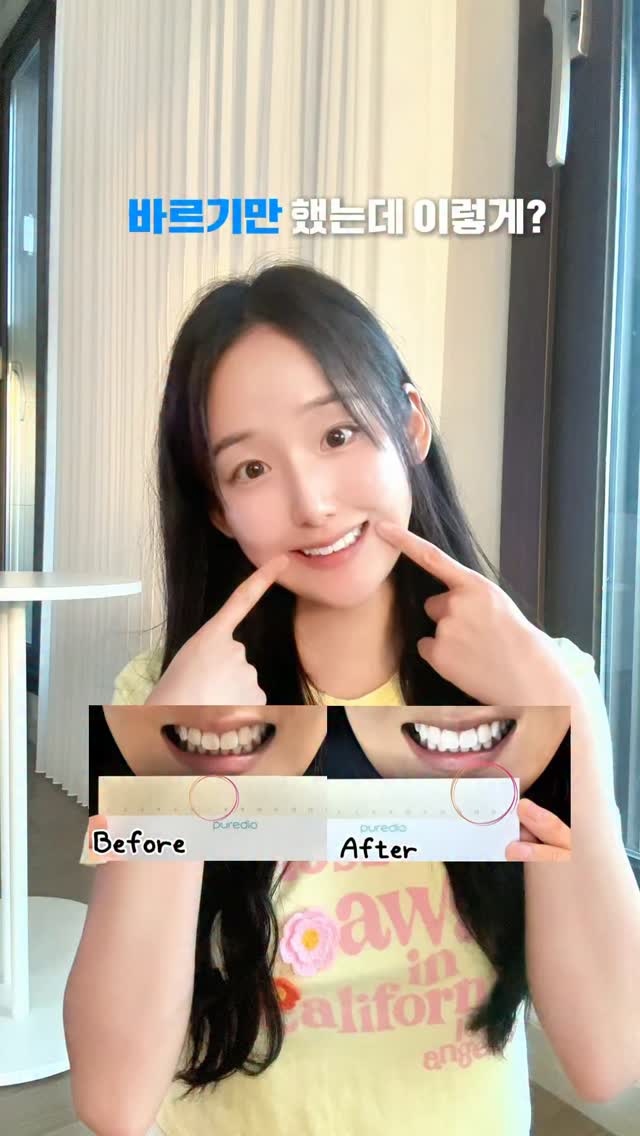 @dasom_lovely이 올린 라이브오랄스 태그 게시물