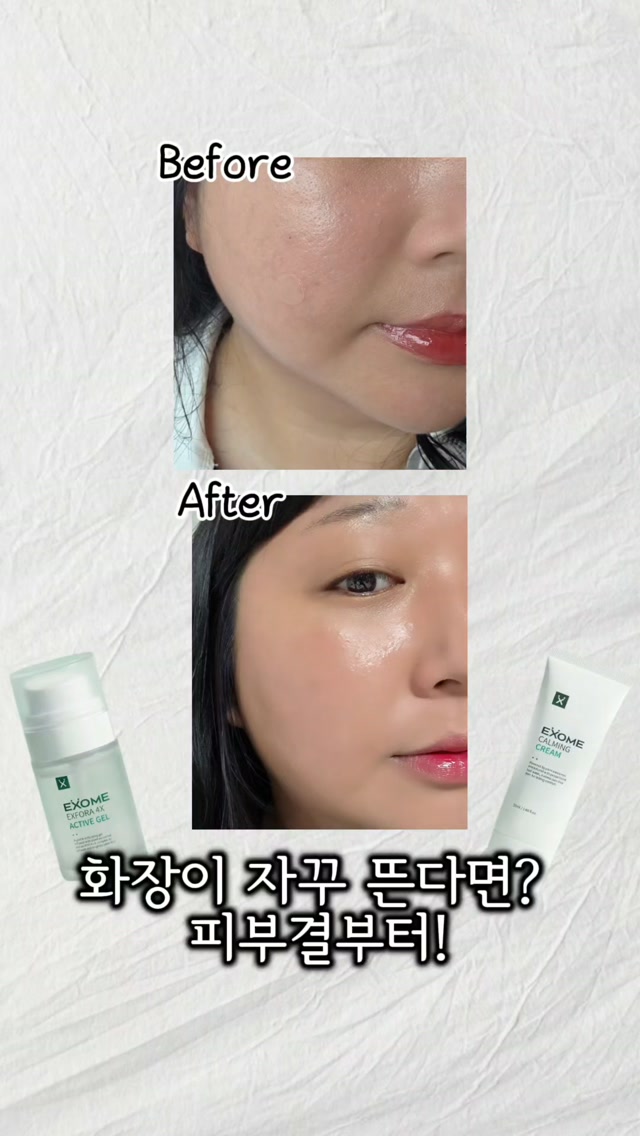 @beautiru_이 올린 엑솜 태그 게시물