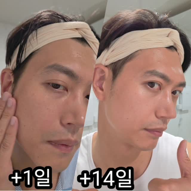 @ssunpapa이 올린 멜로스킨 태그 게시물
