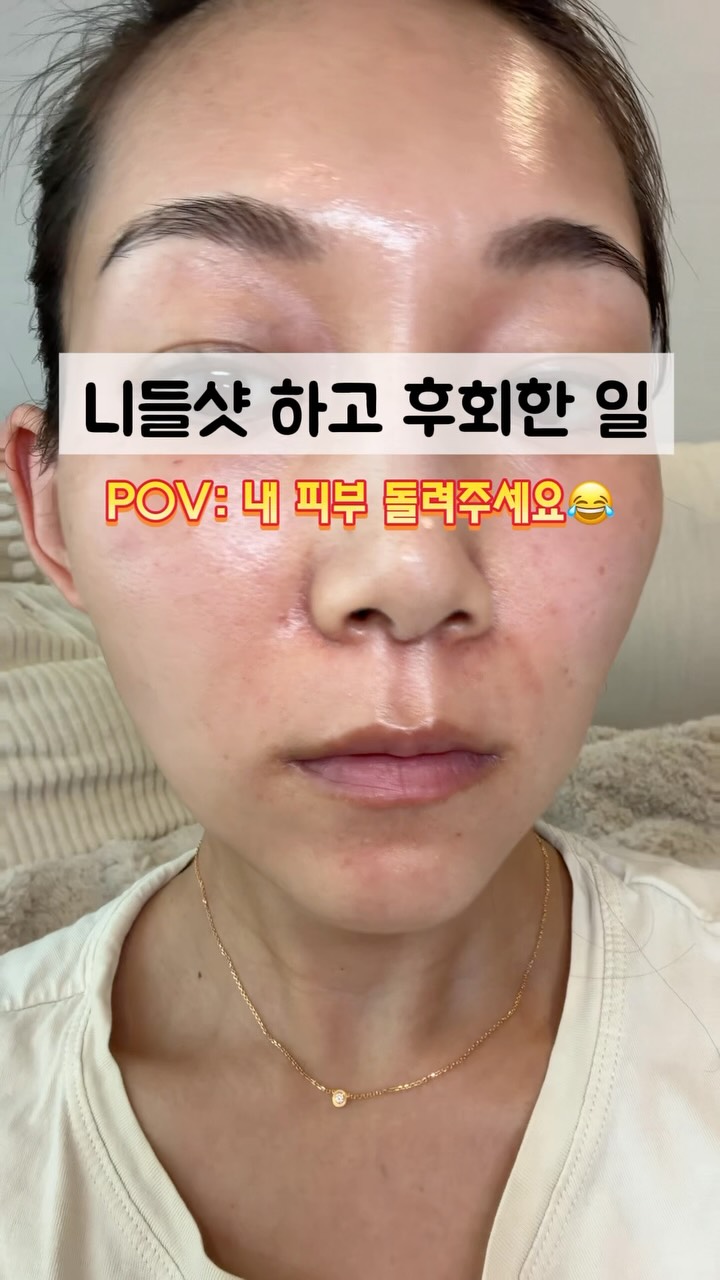 @lovely._.miii이 올린 하리마로 태그 게시물
