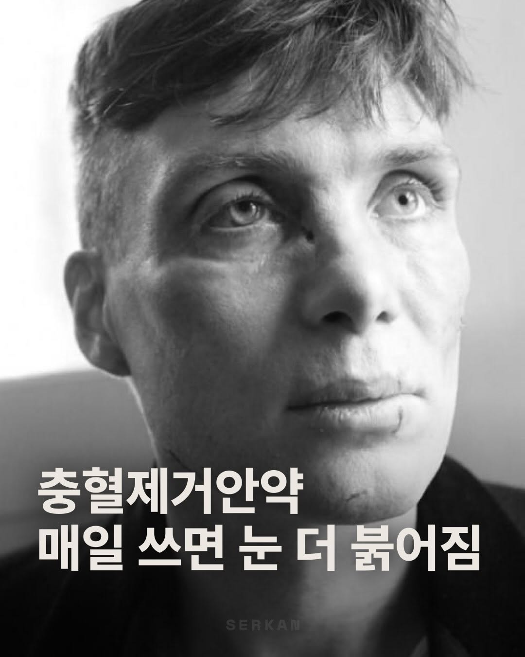 @iamtheserkan이 올린 바슈롬 렌즈 태그 게시물