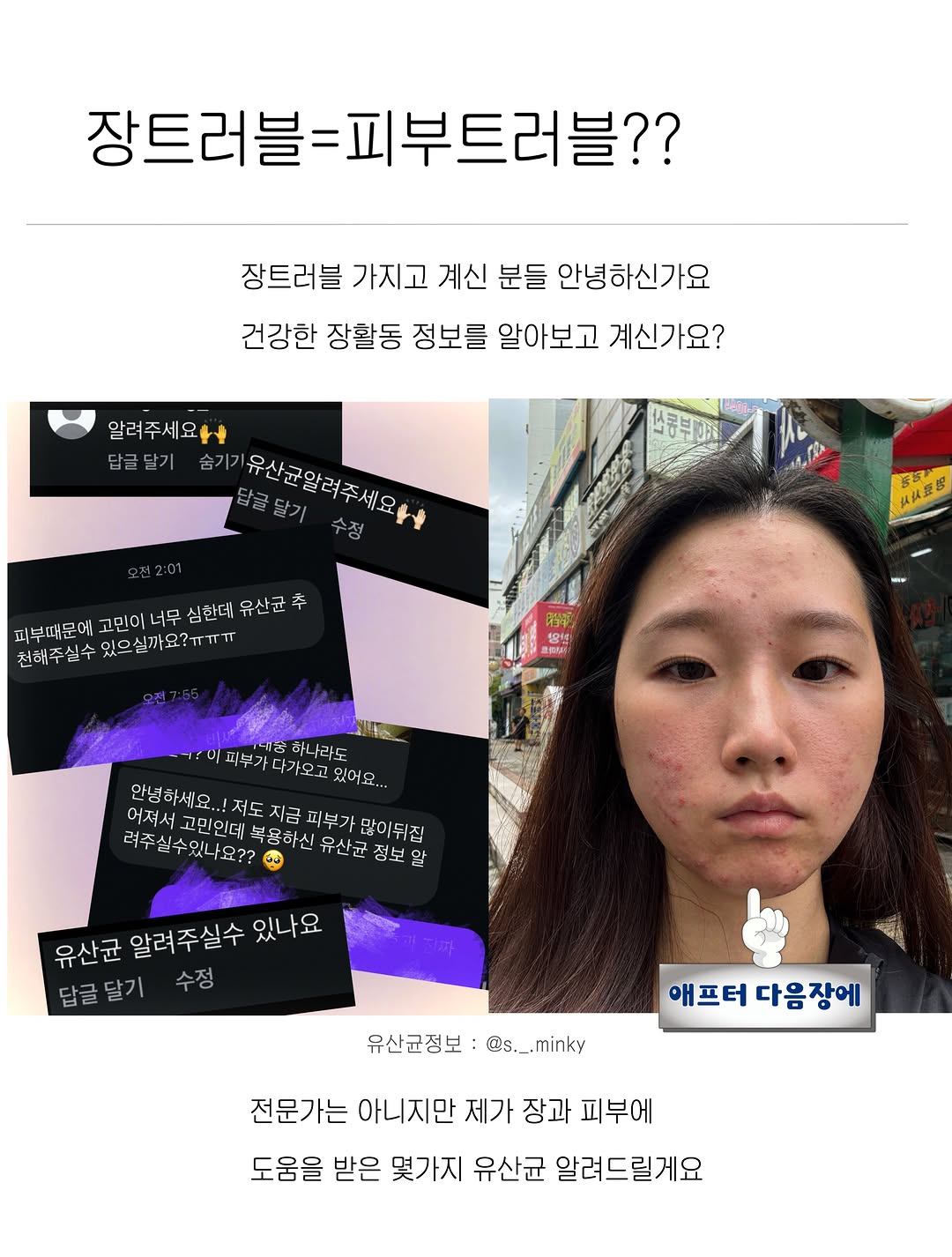 @s._.minky이 올린 에이스바이옴 태그 게시물