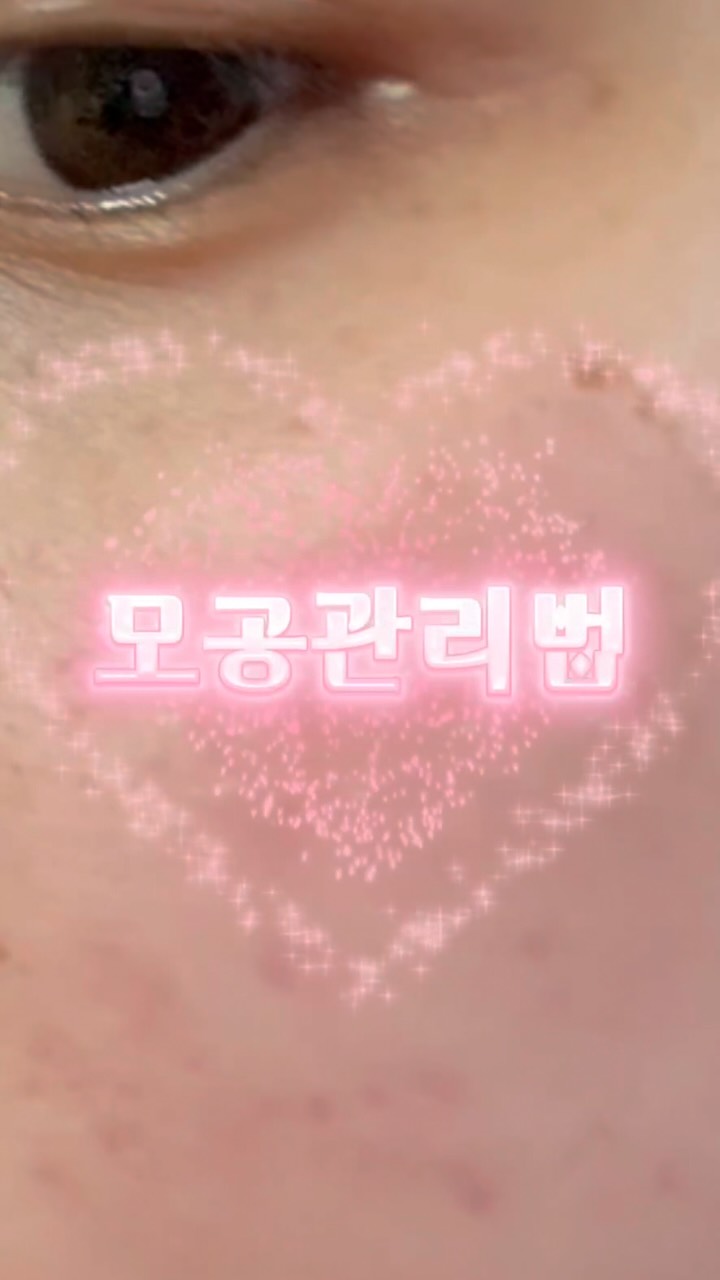 @dermarecord이 올린 코이터널 태그 게시물