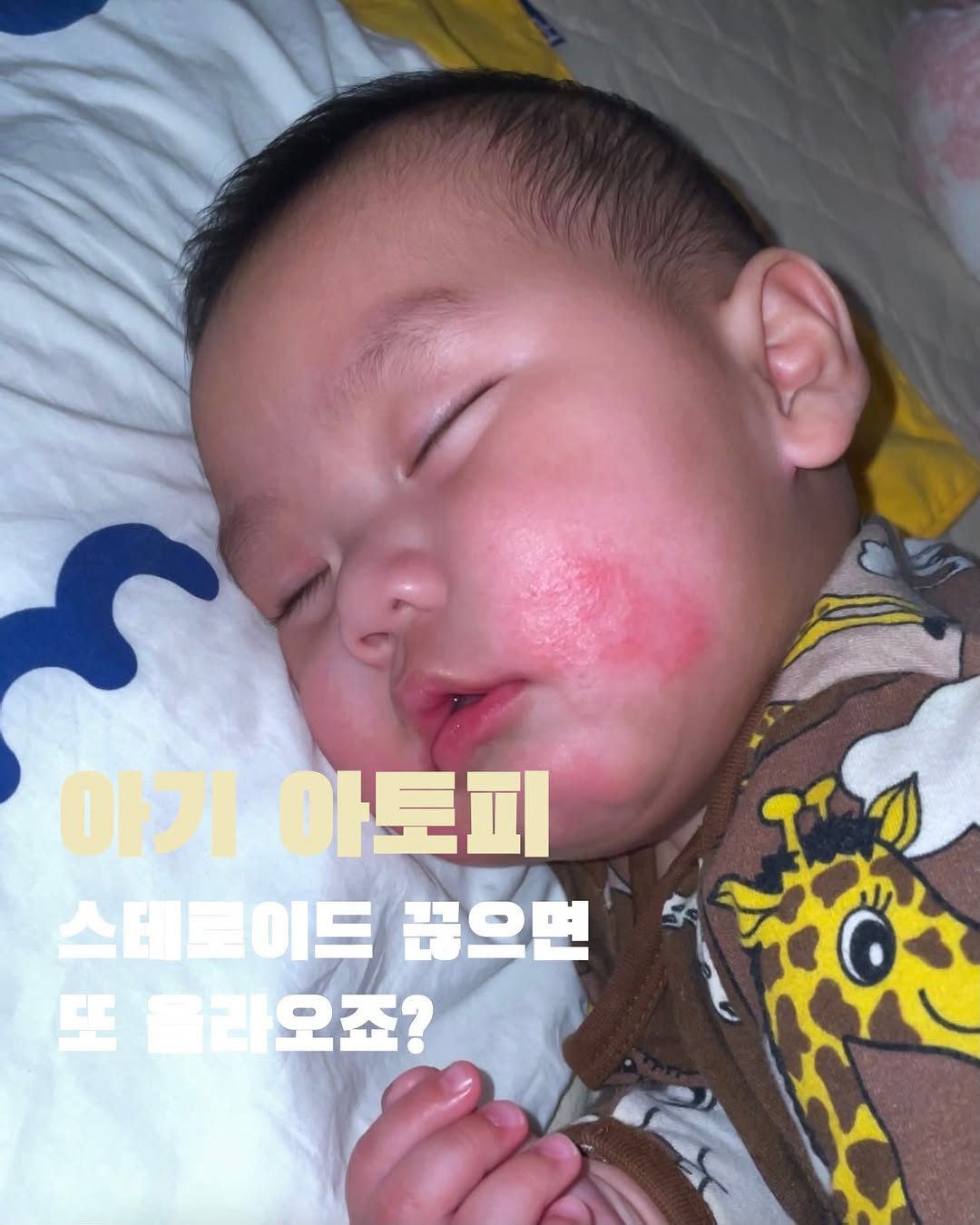 @yangbo_editor이 올린 닥터큐비오 태그 게시물