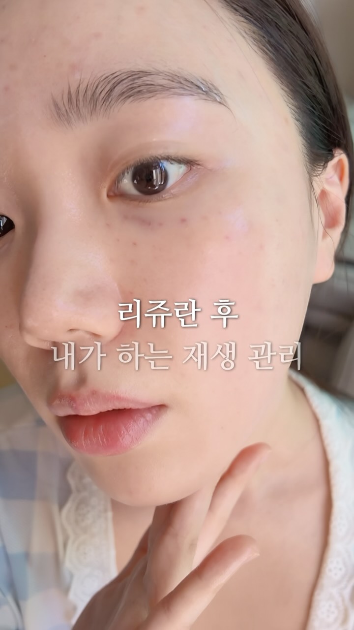 @eunoo.story이 올린 셀퓨전씨 태그 게시물