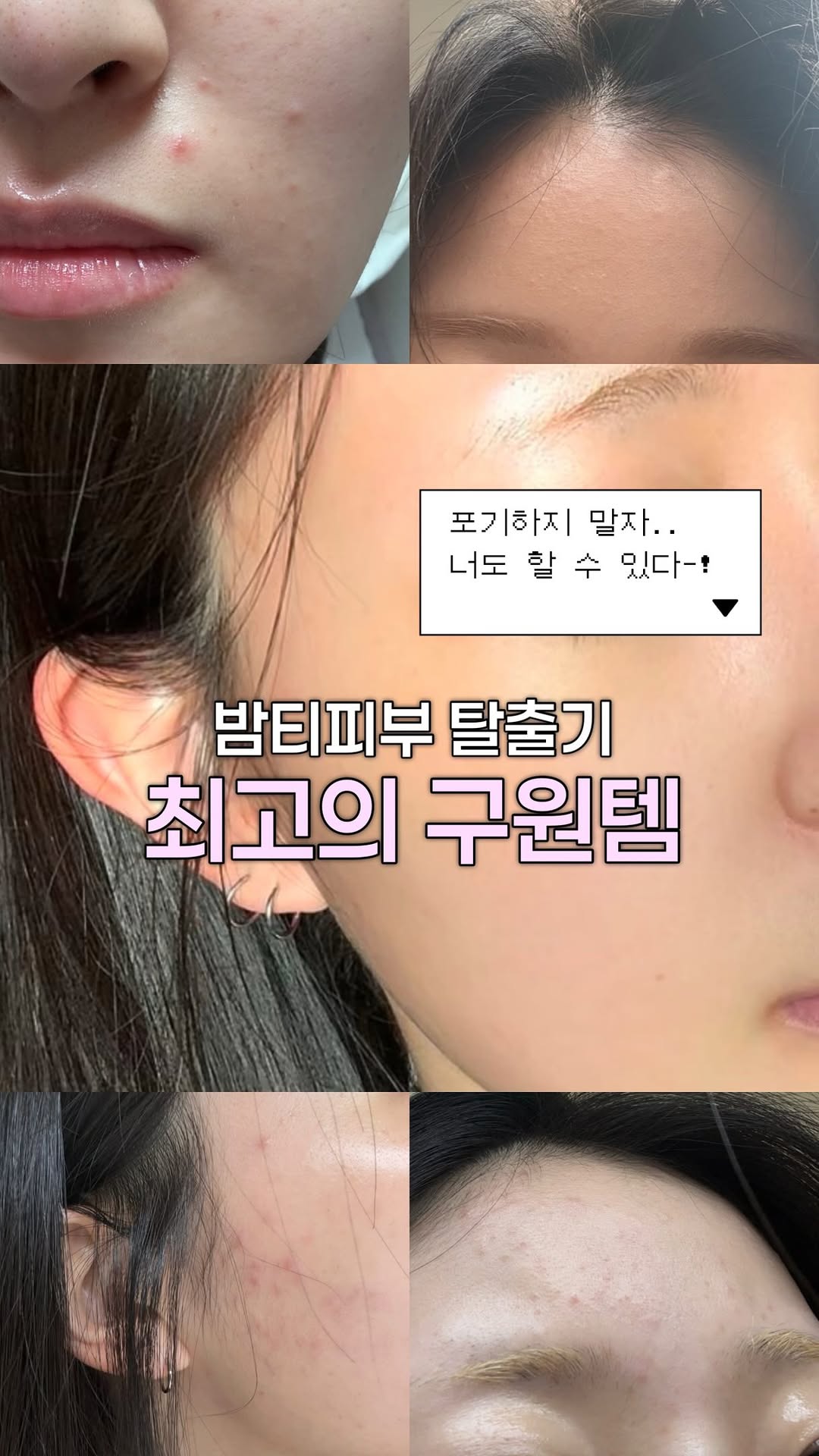@zzya.n__이 올린 닥터자르트 태그 게시물