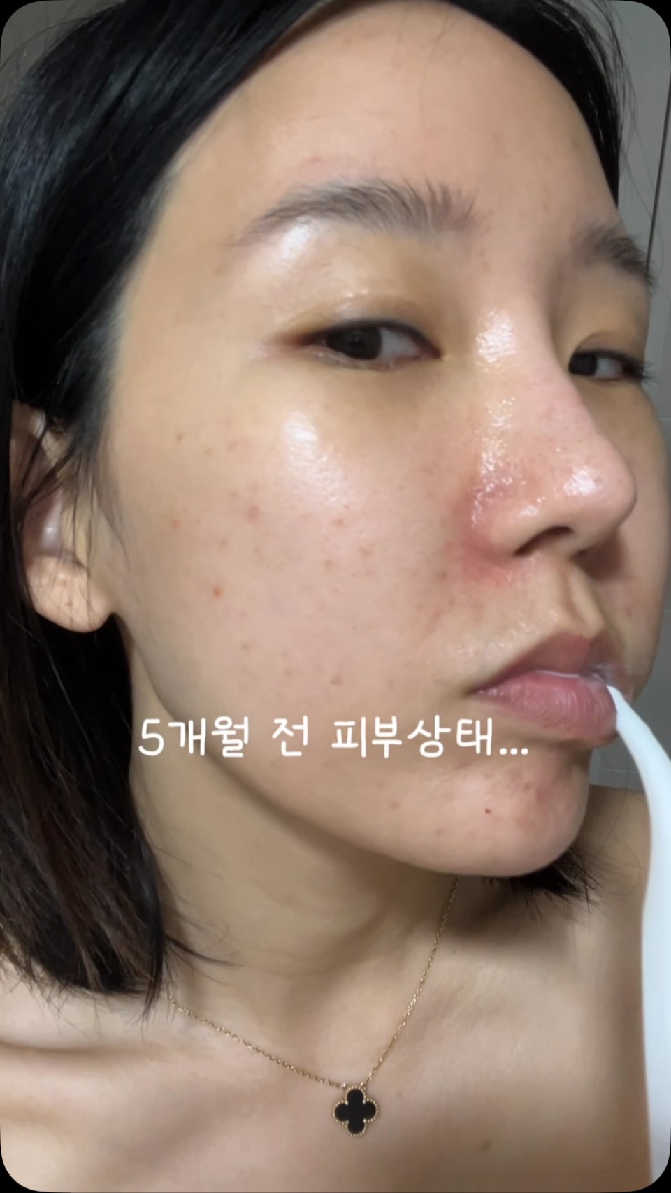 @a.a_ju.u이 올린 쿼드쎄라 뷰티디바이스 스페셜홈케어 태그 게시물