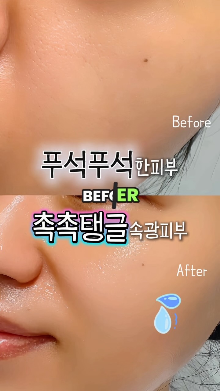 엑쎄라피 EXERAPY 광고 소재