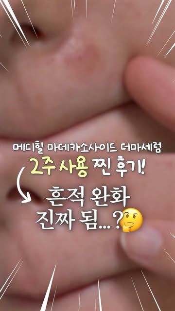하욘 Hayon💞 인스타그램 대표 콘텐츠 6
